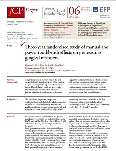 Three-year study concludes power brushes do not cause more soft-tissue trauma than manual brushes – JCP Digest