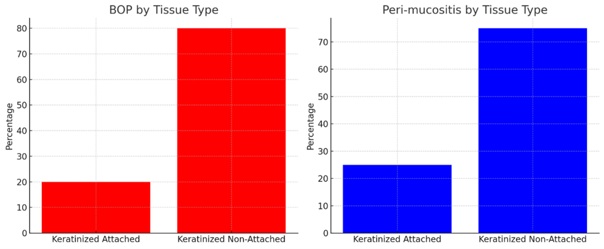 Bar chart