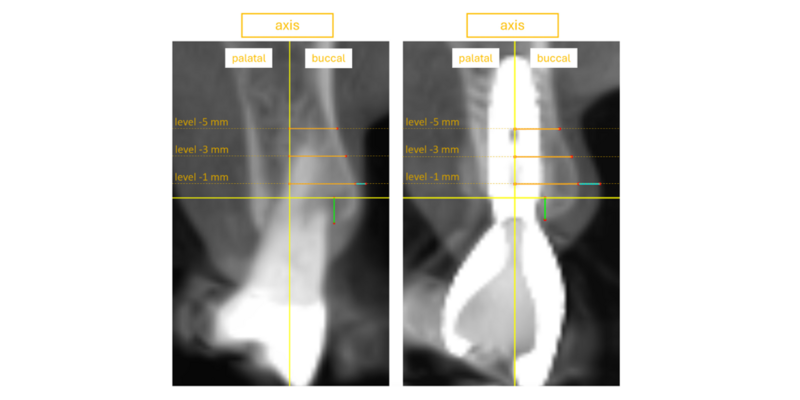 X-Ray Image