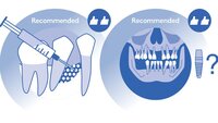 Banner new infographic stage IV periodontitis