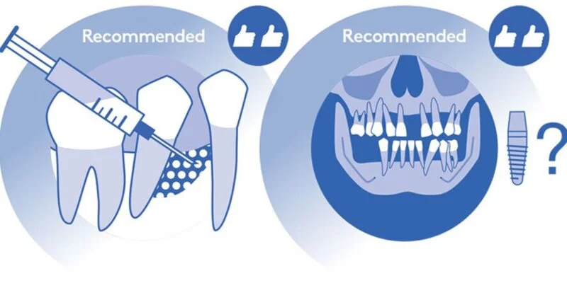 Banner new infographic stage IV periodontitis