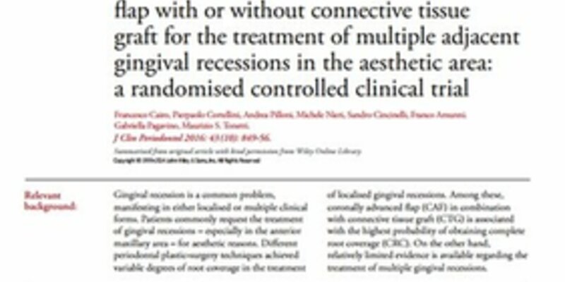 Coronally advanced flap surgery is more effective in treating certain multiple gingival recessions when combined with connective tissue graft – JCP Digest