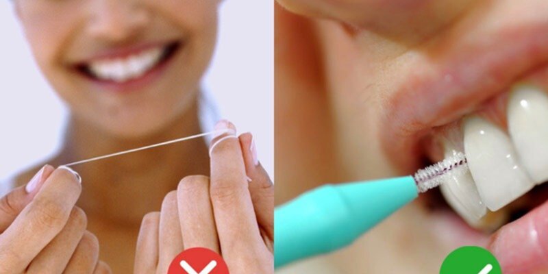 EFP provides clear guidance to public on interdental cleaning in response to media controversy about flossing