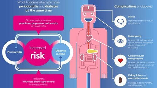 EFP highlights perio-diabetes link on World Diabetes Day