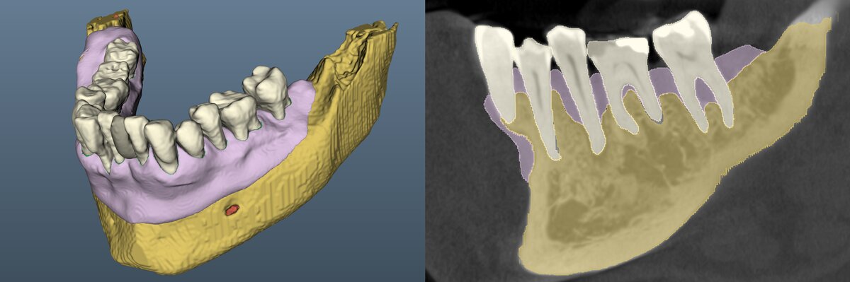 Image of virtual patient