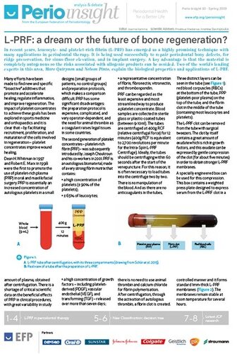 Perio Insight focuses on L-PRF in periodontal therapy