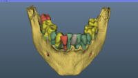 Graphic of jaw with teeth