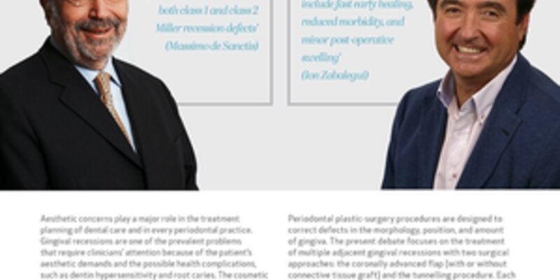 Latest issue of Perio Insight puts spotlight on tunnel or flap technique to treat multiple adjacent gingival recessions