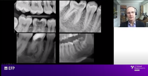 Ian Needleman explains relationship between oral health and sports performance in elite athletes