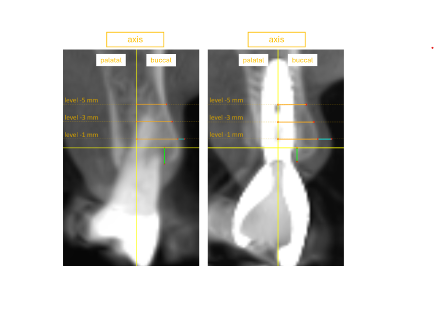 X-ray image