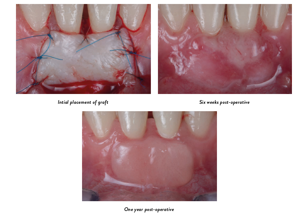 Clinical photos