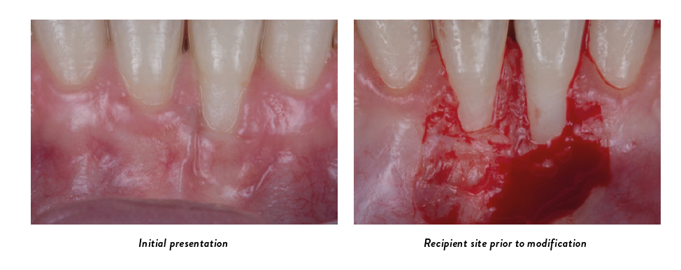 Clinical photos