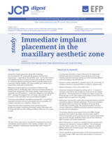 Immediate implant placement in the maxillary aesthetic zone